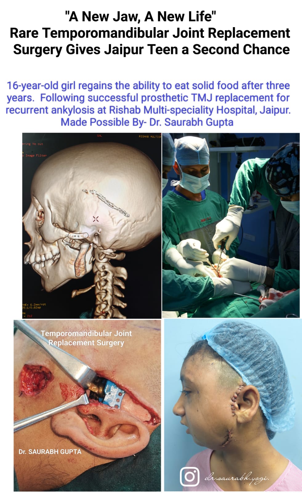 TMJ Joint Replacement Surgery and Jaw Reconstruction in Jaipur