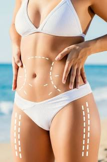 Body Contouring Surgery