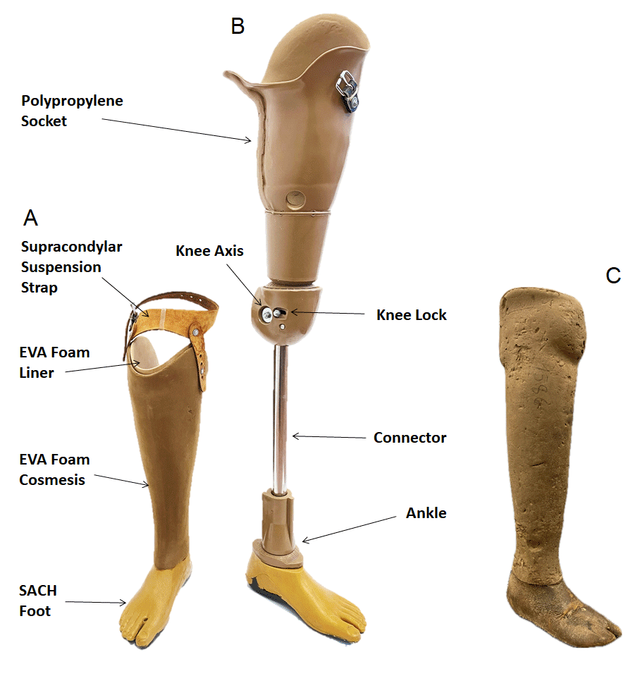 Limb Replacement Surgery