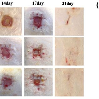 Wound Defects Treatment